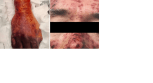 عجوز ستيني يفارق الحياة بعد أن قام كلبه بلعق وجهه