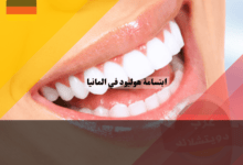 ابتسامة هوليود في المانيا