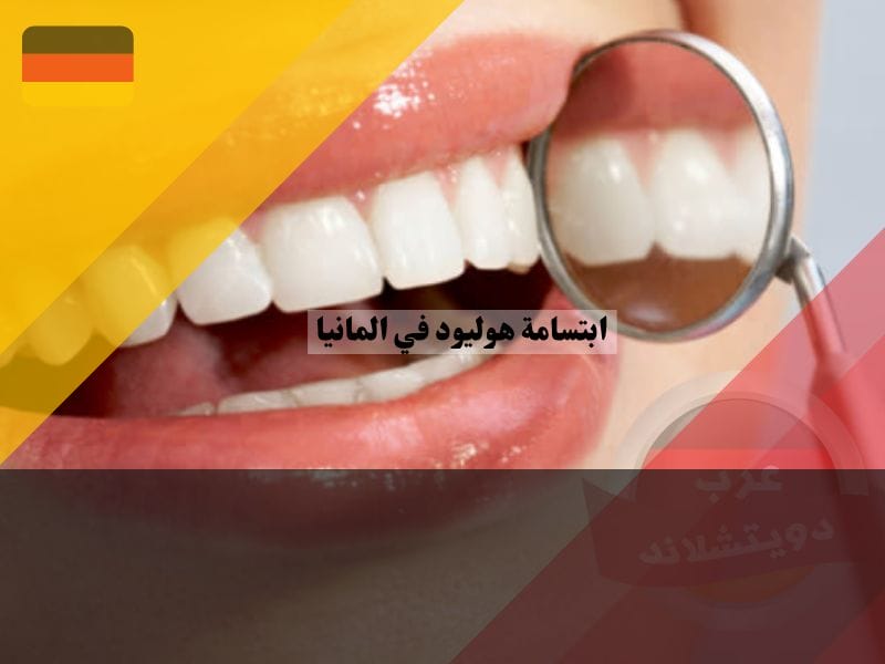 هل يغطي تأمين الأسنان علاج ابتسامة هوليود في المانيا