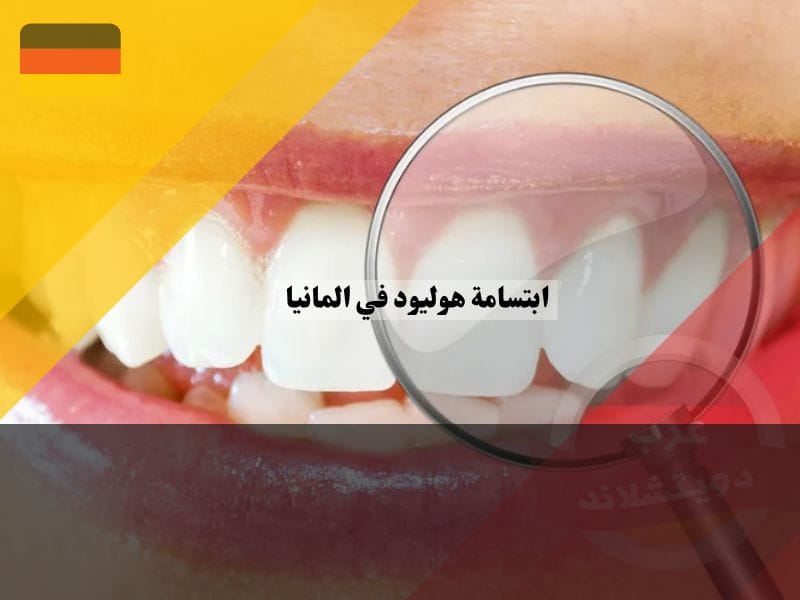 معلومات عن ابتسامة هوليود في المانيا