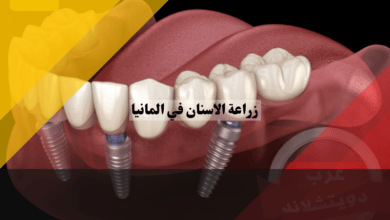زراعة الاسنان في المانيا